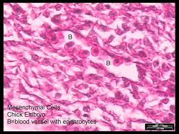 Colitis in Test Mice Responds to Treatment with Human Umbilical Cord-Derived Mensenchymal Cells