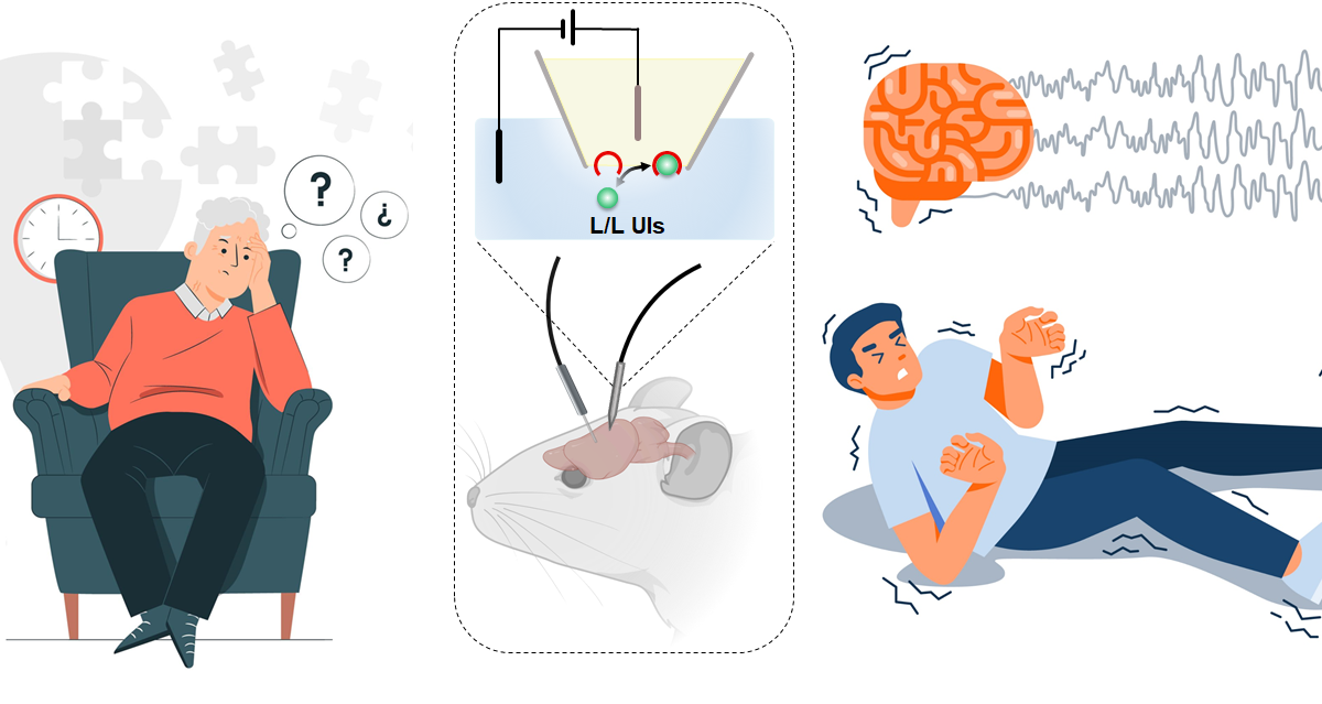 Ultramicro Iontronics Enables Dynamic Tracking of Cerebral Chloride Regulation